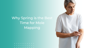 mole mapping