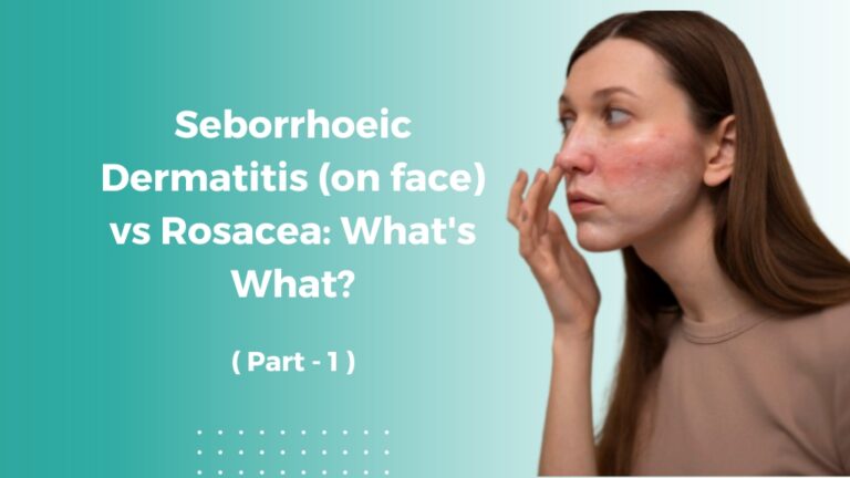 Seborrhoeic Dermatitis (on face) vs Rosacea: What's What? - Dr E ...