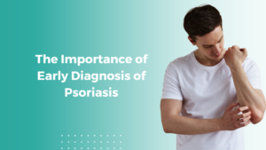Psoriasis treatment