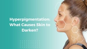 What causes Hyperpigmentation