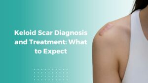 Treatment for Keloid scar