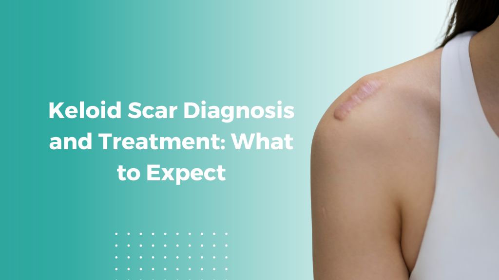 Treatment for Keloid scar