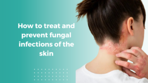 Fungal infection of skin