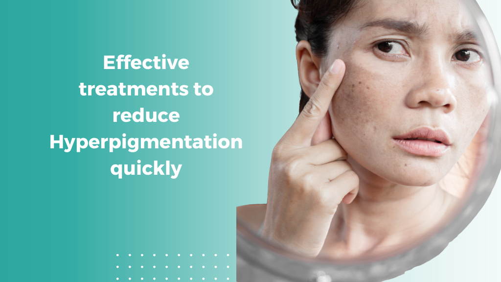 Effective treatments to reduce Hyperpigmentation quickly