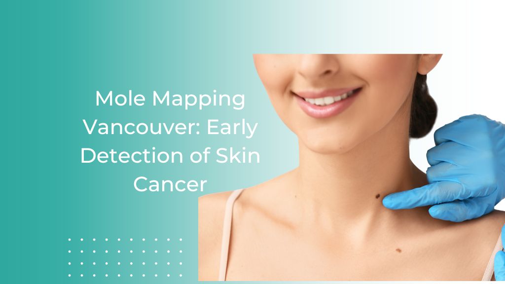 Mole Mapping Vancouver: Early Detection of Skin Cancer