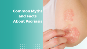Common Myths and Facts About Psoriasis