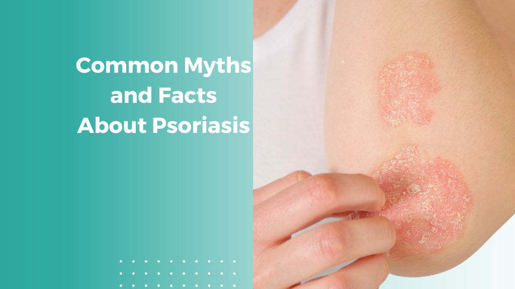 Common Myths and Facts About Psoriasis